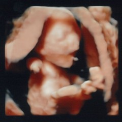 経腹超音波妊娠17週0日