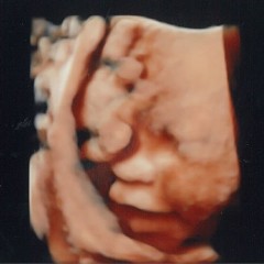 妊娠32週6日